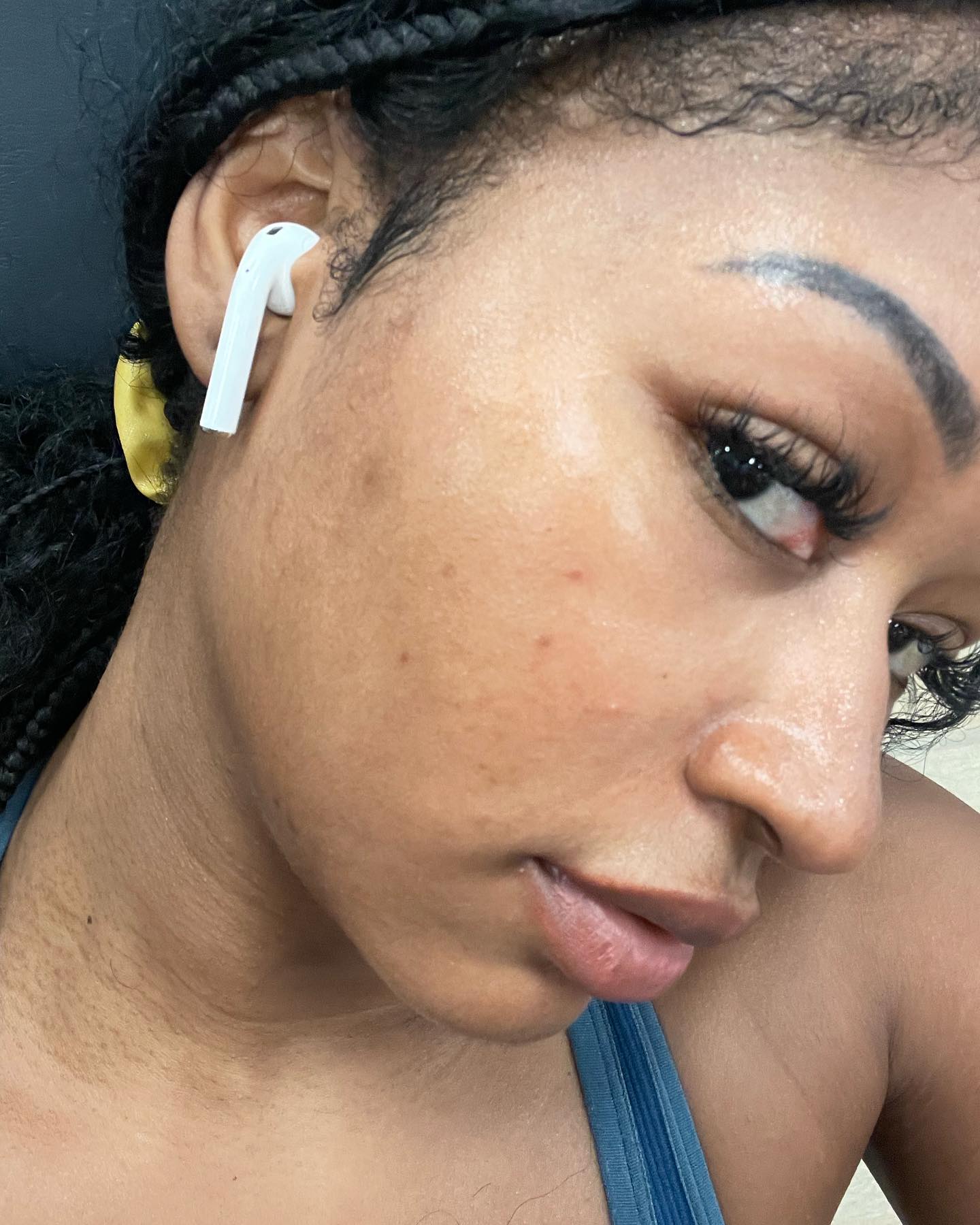 Clear, glowing skin after using A&H Kit