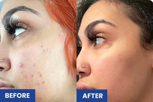 Before and after using A&H Kit